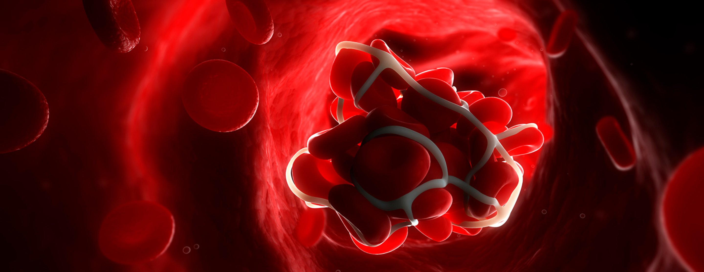 Euglobulin Lysis Time Medical Tests UCSF Health