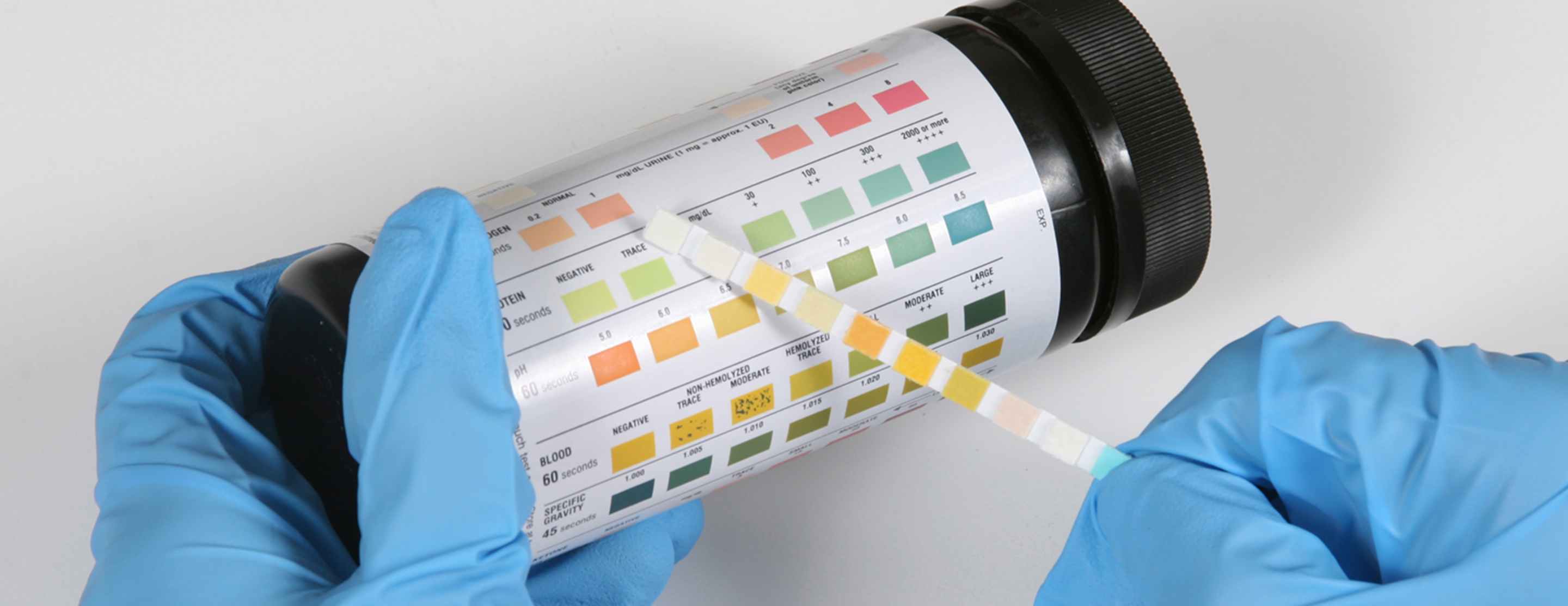 Glucose Urine Test