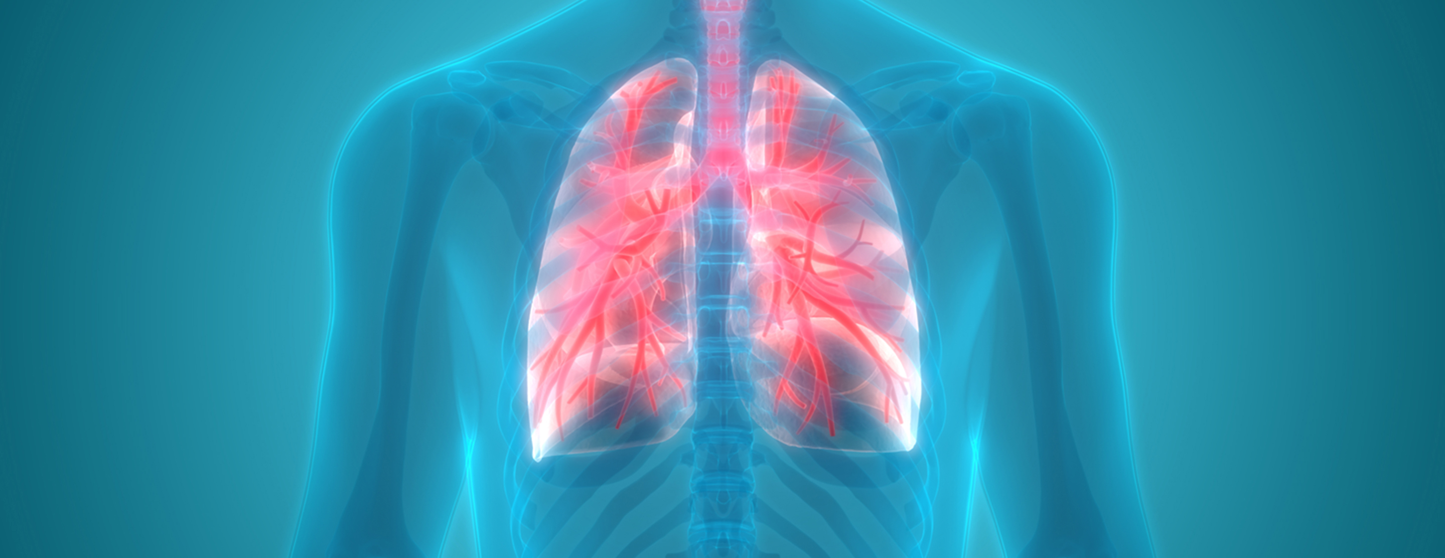 Lung needle biopsy