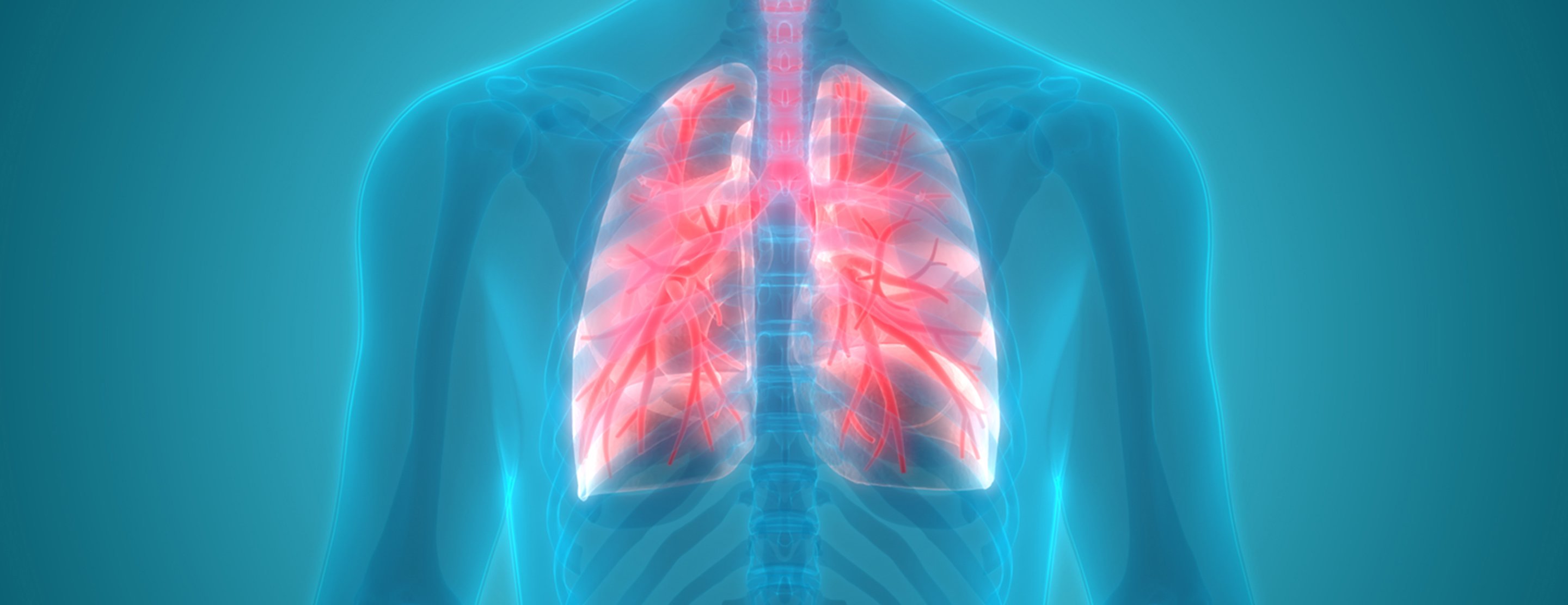 Lung Needle Biopsy