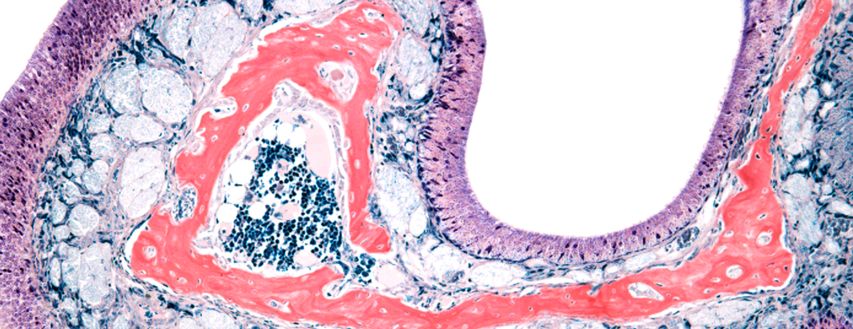 Nasal Mucosal Biopsy