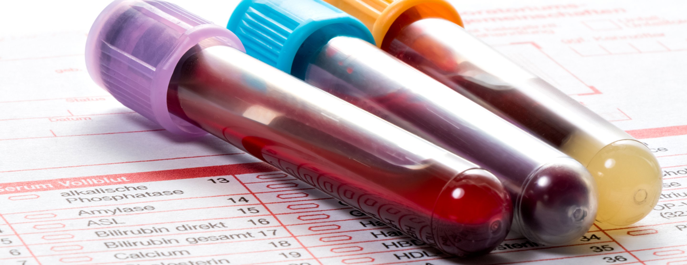 Parathyroid Hormone related Protein Blood Test