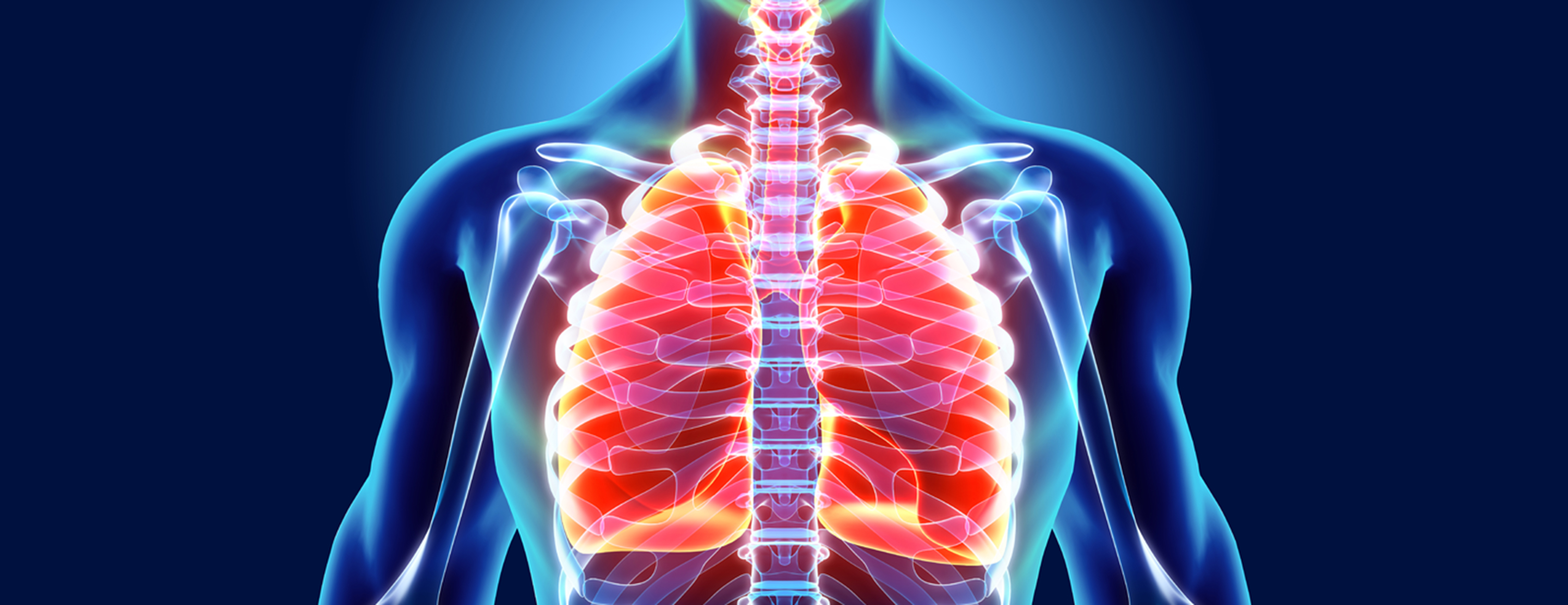 Thoracentesis