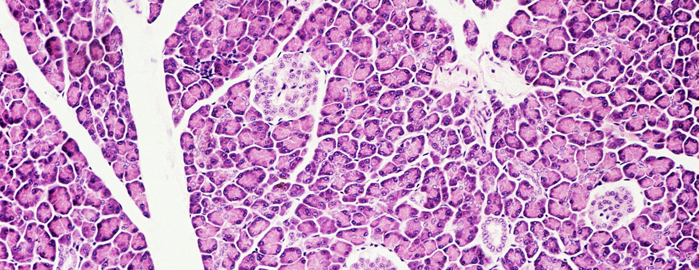 trypsin-and-chymotrypsin-in-stool