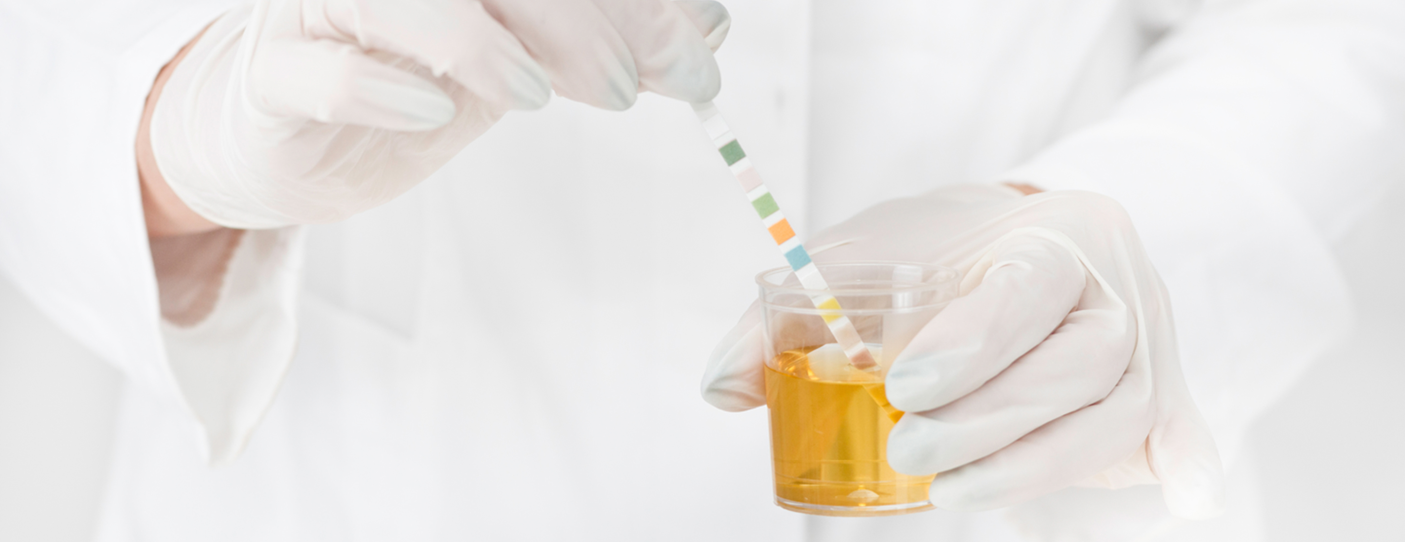 Urine PH Test