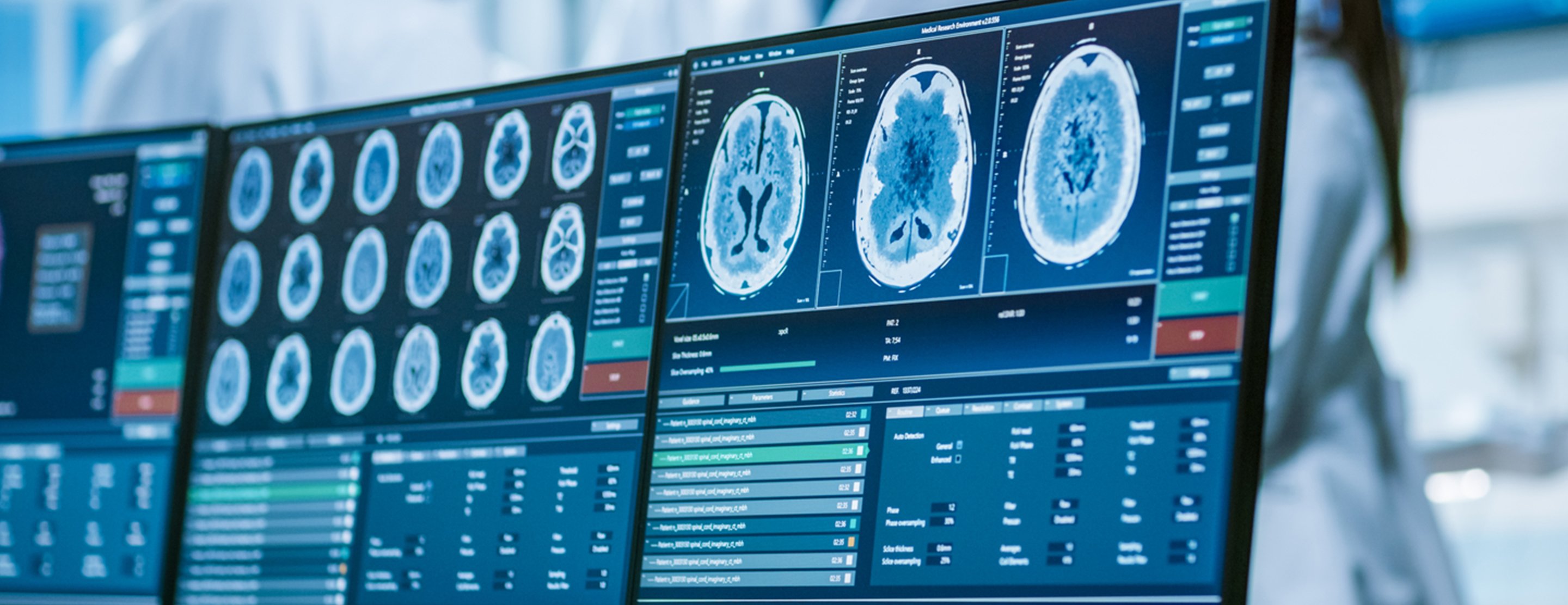 brain-mapping-qeeg-assessment-synapse-chicago